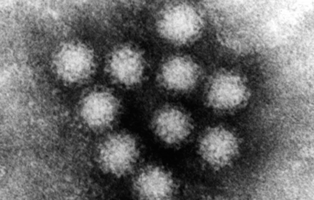 This negative-stain transmission electron microscopy image, provided by the EPA, shows a norovirus. Norovirus is a genus of viruses of the family Caliciviridae. (Via AP)